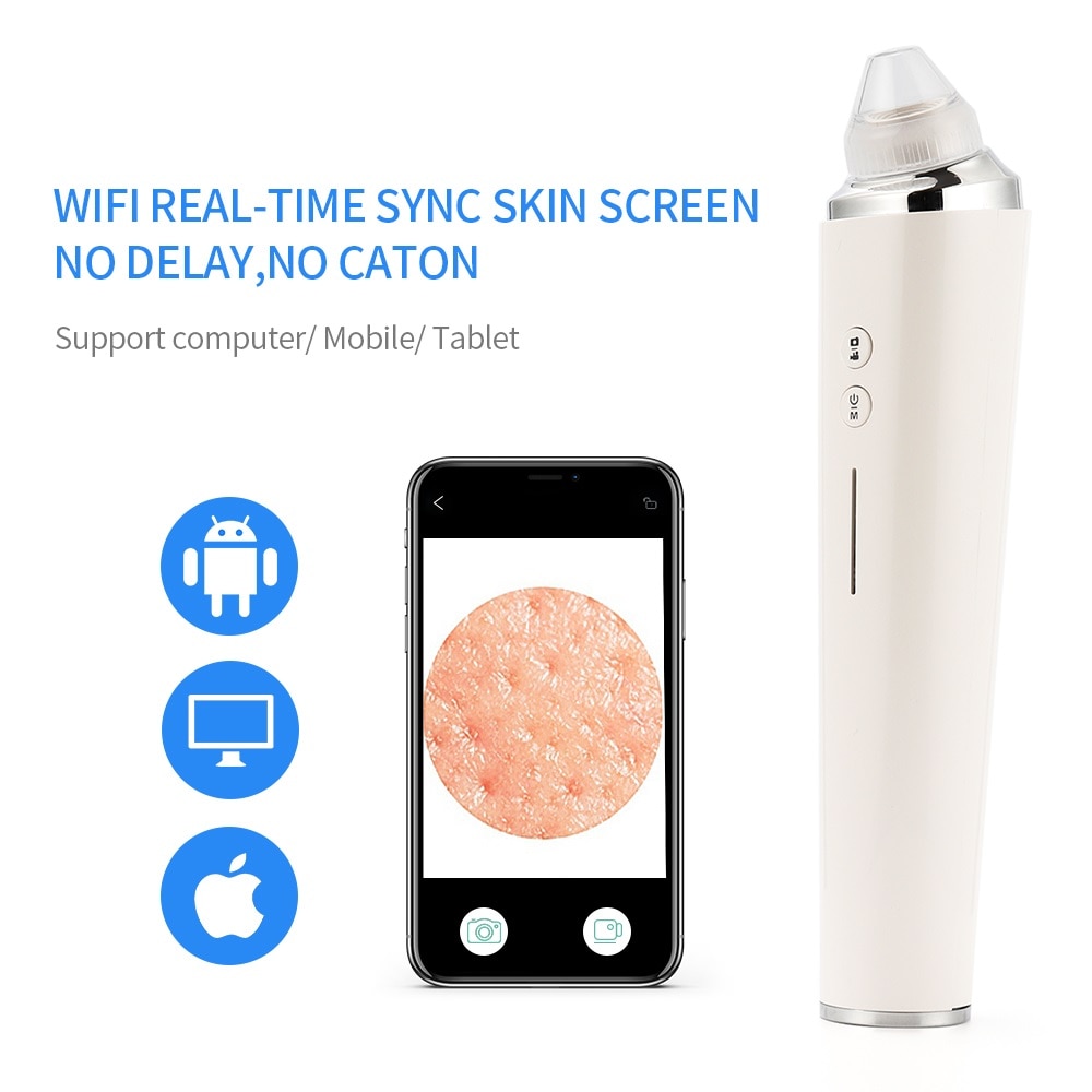 USB Rechargeable Blackhead Remover Vacuum