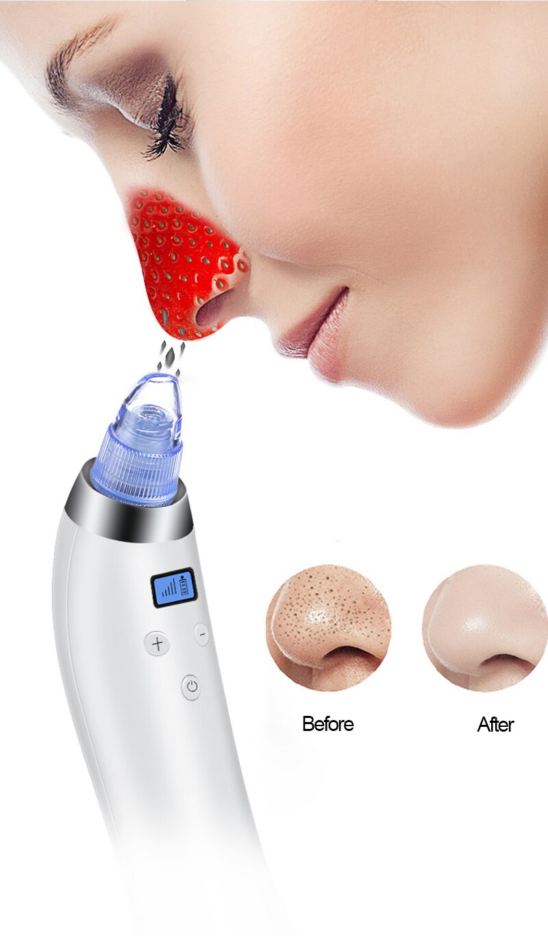 Microdermabrasion Removal Pen 